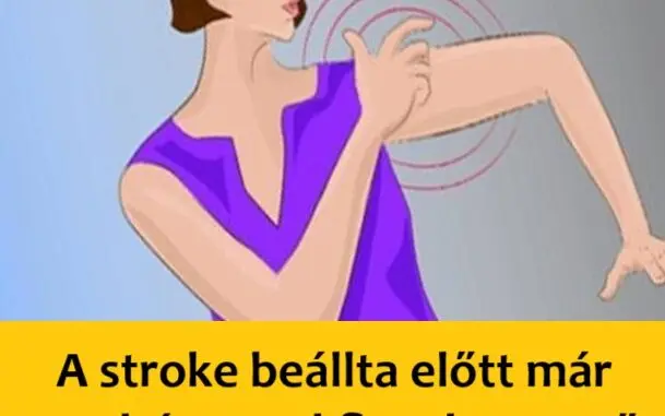 fs stroke