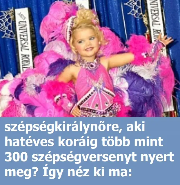 szepseg913fa3a